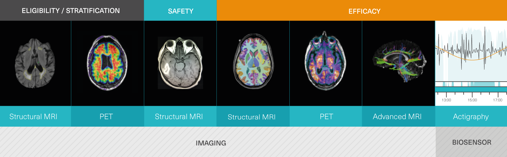 Parkinson's Disease (PD) » IXICO