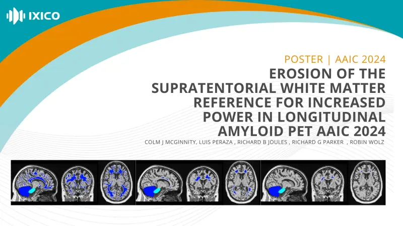 Erosion of The Supratentorial White Matter Reference for Increased Power in Longitudinal Amyloid PET 