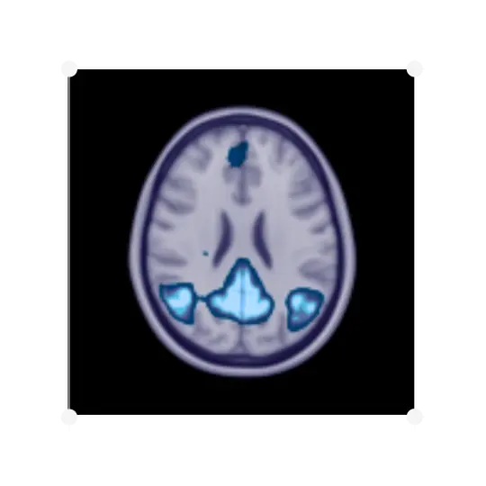 Resting State Functional MRI (fMRI)